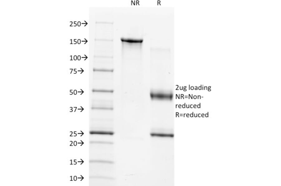 SDS-PAGE - Anti-TIMP1 Antibody [2A5] - BSA and Azide free (A253309) - Antibodies.com