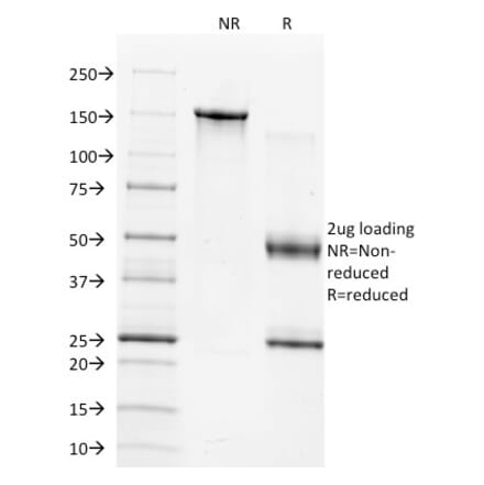 SDS-PAGE - Anti-TIMP1 Antibody [2A5] - BSA and Azide free (A253309) - Antibodies.com