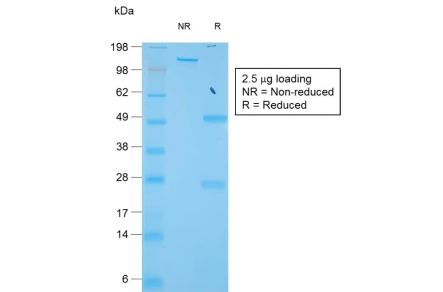 SDS-PAGE - Anti-TIMP1 Antibody [TIMP1/1944R] - BSA and Azide free (A253311) - Antibodies.com
