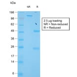 SDS-PAGE - Anti-TIMP1 Antibody [TIMP1/1944R] - BSA and Azide free (A253311) - Antibodies.com