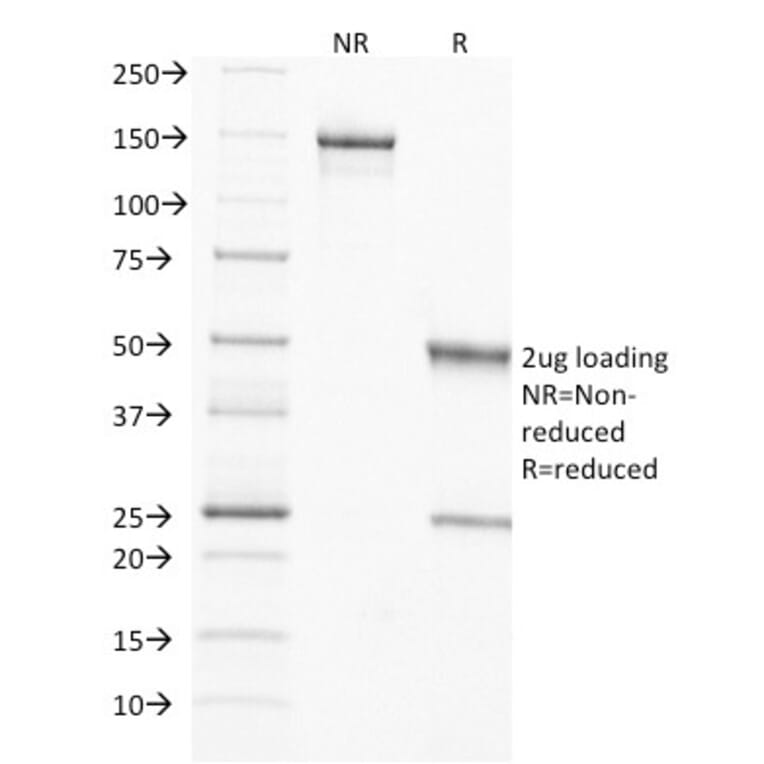 SDS-PAGE - Anti-TIMP2 Antibody [3A4] - BSA and Azide free (A253313) - Antibodies.com