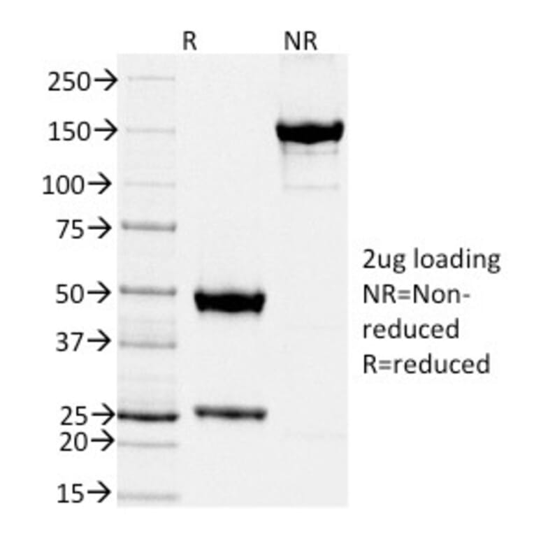 SDS-PAGE - Anti-TIMP2 Antibody [TIMP2/2044] - BSA and Azide free (A253315) - Antibodies.com