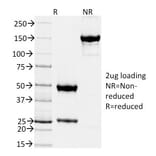 SDS-PAGE - Anti-TIMP2 Antibody [TIMP2/2044] - BSA and Azide free (A253315) - Antibodies.com