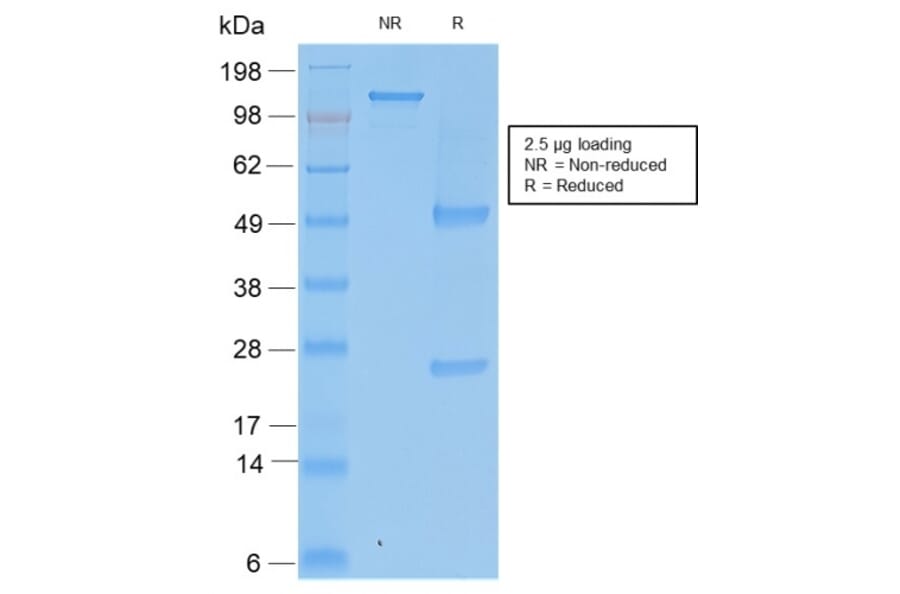 SDS-PAGE - Anti-TIMP2 Antibody [rTIMP2/2335] - BSA and Azide free (A253316) - Antibodies.com