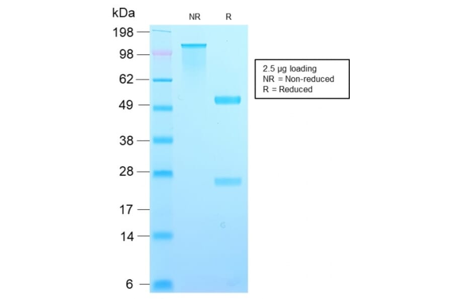 SDS-PAGE - Anti-TIMP2 Antibody [TIMP2/2488R] - BSA and Azide free (A253317) - Antibodies.com