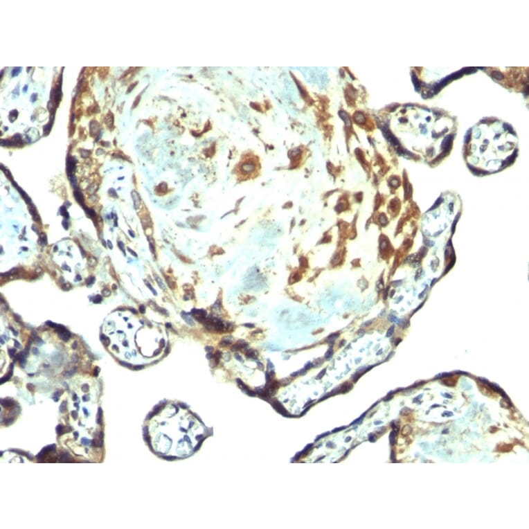 Immunohistochemistry - Anti-TIMP3 Antibody - BSA and Azide free (A253317) - Antibodies.com