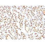 Immunohistochemistry - Anti-TTF1 Antibody [8G7G3/1] - BSA and Azide free (A253319) - Antibodies.com