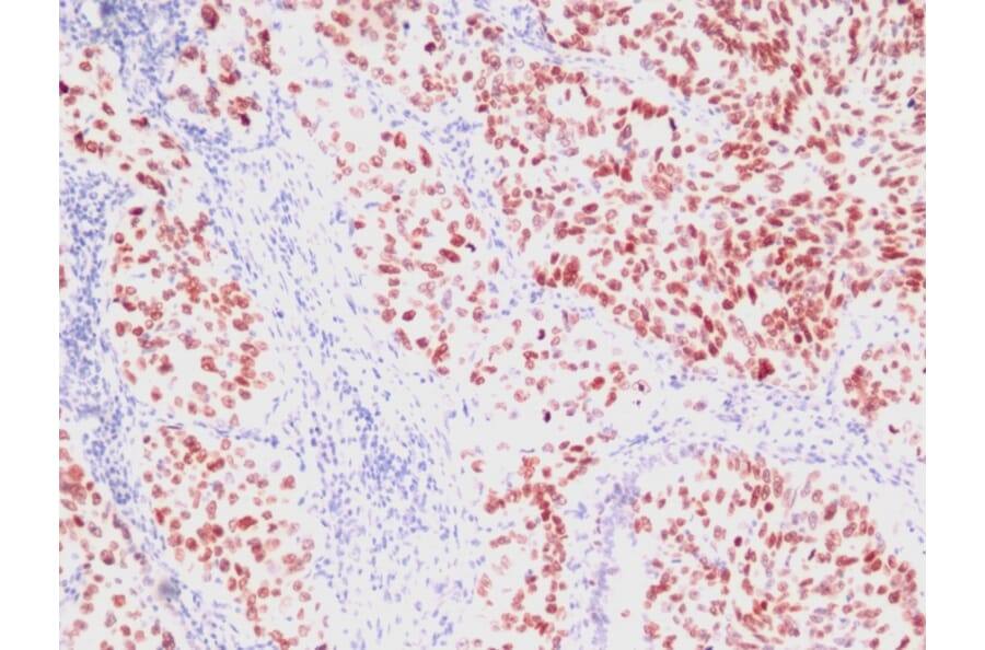 Immunohistochemistry - Anti-TTF1 Antibody [SPM150] - BSA and Azide free (A253319) - Antibodies.com
