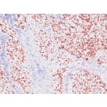 Immunohistochemistry - Anti-TTF1 Antibody [SPM150] - BSA and Azide free (A253319) - Antibodies.com