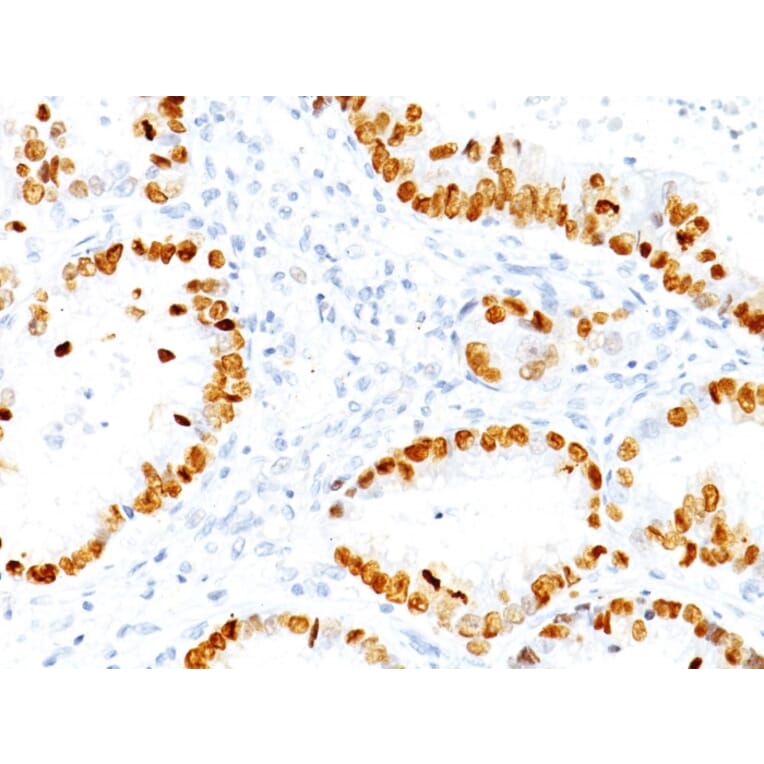Immunohistochemistry - Anti-TTF1 Antibody [NX2.1/690] - BSA and Azide free (A253320) - Antibodies.com