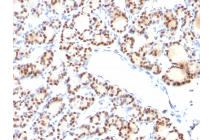 Immunohistochemistry - Anti-TTF1 Antibody [NX2.1/690] - BSA and Azide free (A253321) - Antibodies.com