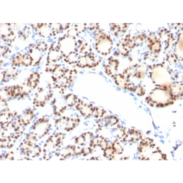 Immunohistochemistry - Anti-TTF1 Antibody [NX2.1/690] - BSA and Azide free (A253321) - Antibodies.com