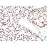 Immunohistochemistry - Anti-TTF1 Antibody [NX2.1/690] - BSA and Azide free (A253321) - Antibodies.com