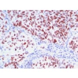 Immunohistochemistry - Anti-TTF1 Antibody [8G7G3/1 + NX2.1/690] - BSA and Azide free (A253321) - Antibodies.com