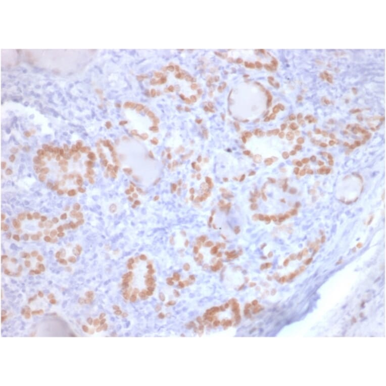 Immunohistochemistry - Anti-TTF1 Antibody [rNX2.1/690] - BSA and Azide free (A253322) - Antibodies.com