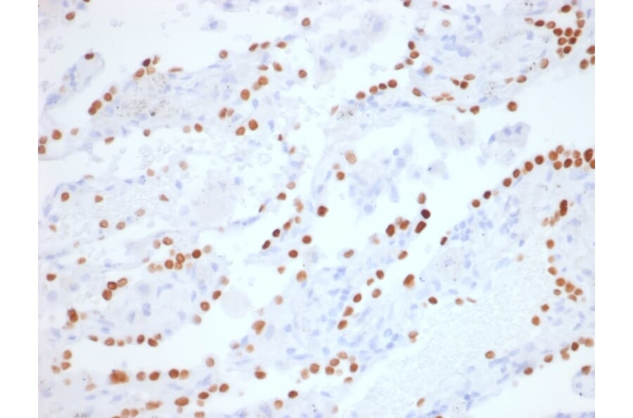 Immunohistochemistry - Anti-TTF1 Antibody [NX2.1/1855R] - BSA and Azide free (A253323) - Antibodies.com