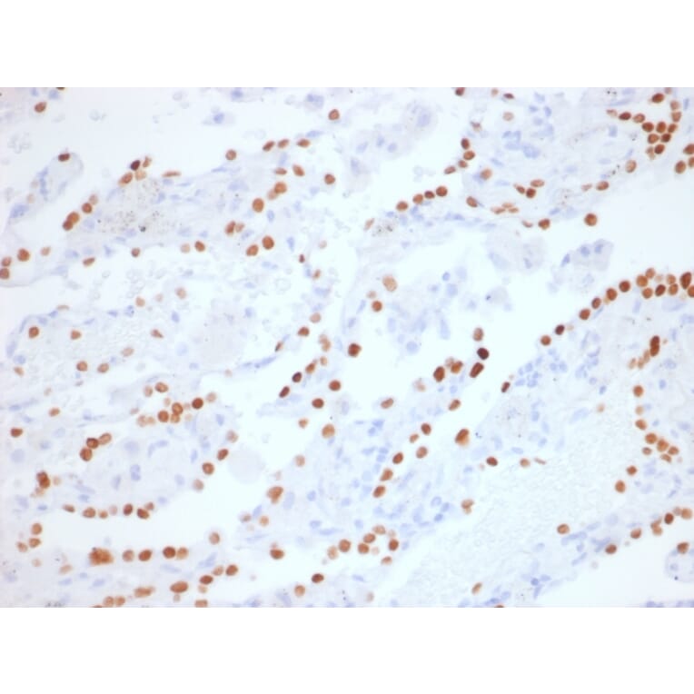 Immunohistochemistry - Anti-TTF1 Antibody [NX2.1/1855R] - BSA and Azide free (A253323) - Antibodies.com
