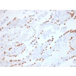 Immunohistochemistry - Anti-TTF1 Antibody [NX2.1/1855R] - BSA and Azide free (A253323) - Antibodies.com