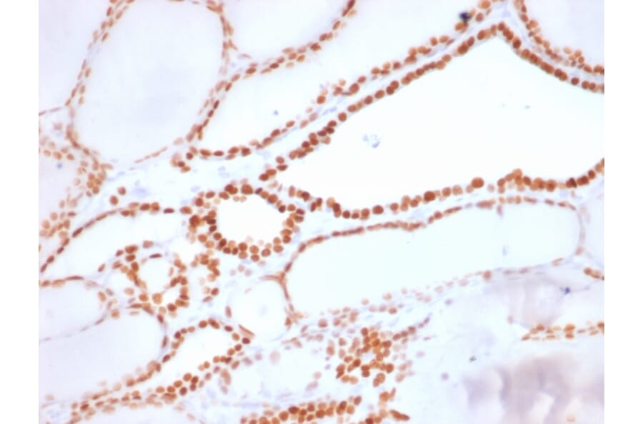 Immunohistochemistry - Anti-TTF1 Antibody [NX2.1/1855R] - BSA and Azide free (A253324) - Antibodies.com