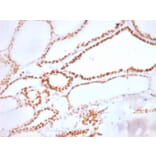 Immunohistochemistry - Anti-TTF1 Antibody [NX2.1/1855R] - BSA and Azide free (A253324) - Antibodies.com