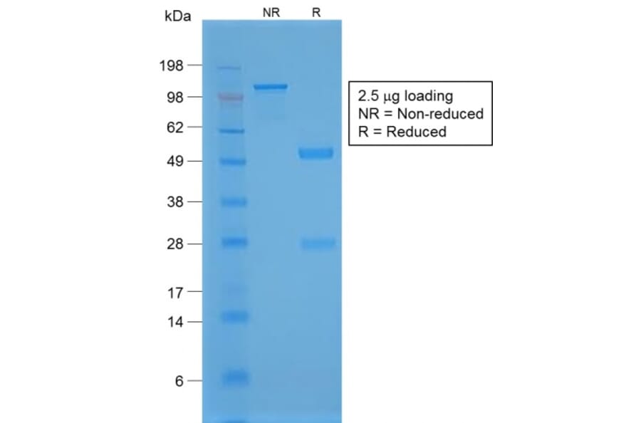 SDS-PAGE - Anti-TTF1 Antibody [NX2.1/1855R] - BSA and Azide free (A253324) - Antibodies.com