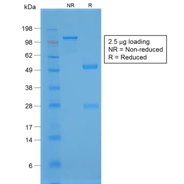 SDS-PAGE - Anti-TTF1 Antibody [NX2.1/1855R] - BSA and Azide free (A253324) - Antibodies.com