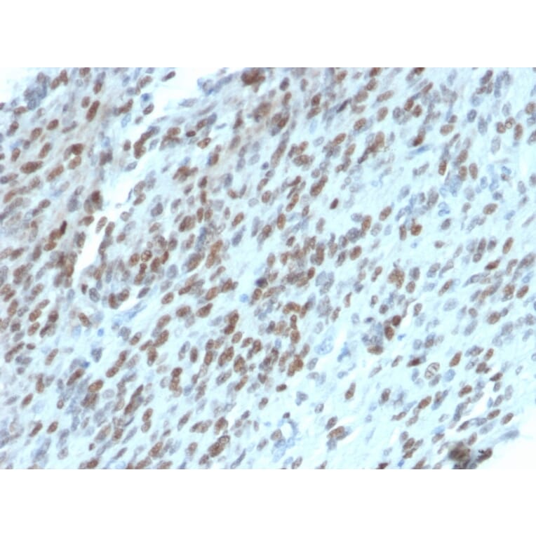 Immunohistochemistry - Anti-TLE1 Antibody [TLE1/2062] - BSA and Azide free (A253326) - Antibodies.com