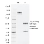 SDS-PAGE - Anti-TLE1 Antibody [TLE1/2062] - BSA and Azide free (A253326) - Antibodies.com