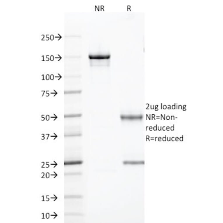 SDS-PAGE - Anti-TLE1 Antibody [TLE1/2085] - BSA and Azide free (A253327) - Antibodies.com