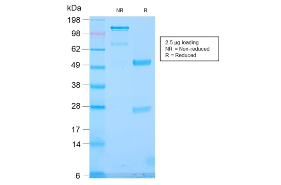 SDS-PAGE - Anti-TLE1 Antibody [TLE1/2946R] - BSA and Azide free (A253328) - Antibodies.com