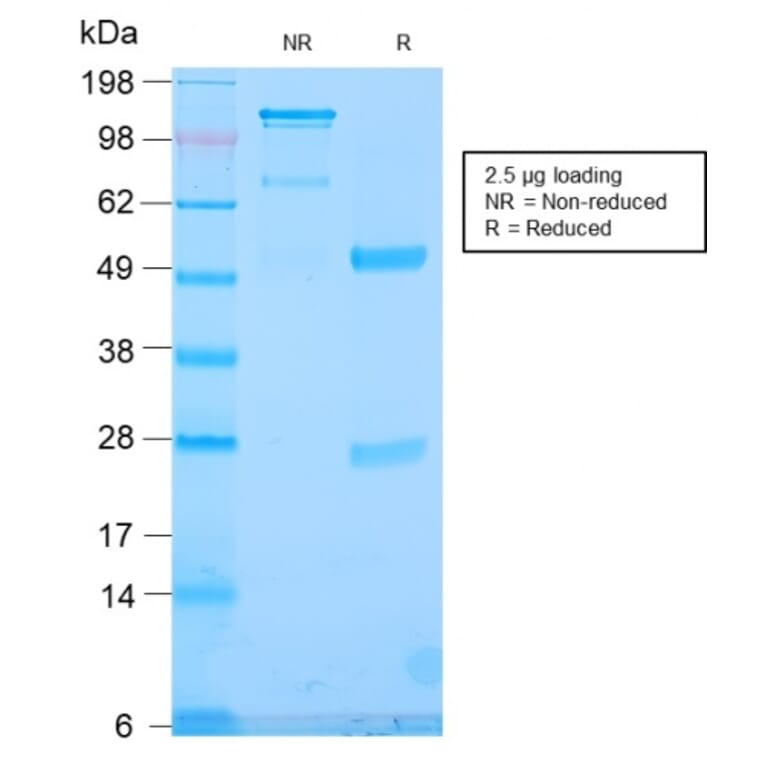 SDS-PAGE - Anti-TLE1 Antibody [TLE1/2946R] - BSA and Azide free (A253328) - Antibodies.com