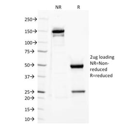 SDS-PAGE - Anti-TLR2 Antibody [TLR2/221] - BSA and Azide free (A253328) - Antibodies.com