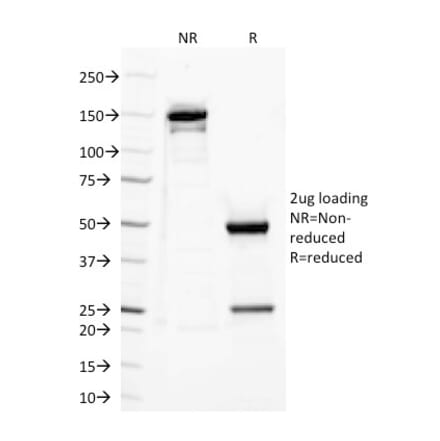 SDS-PAGE - Anti-TLR2 Antibody [TLR2/221] - BSA and Azide free (A253328) - Antibodies.com