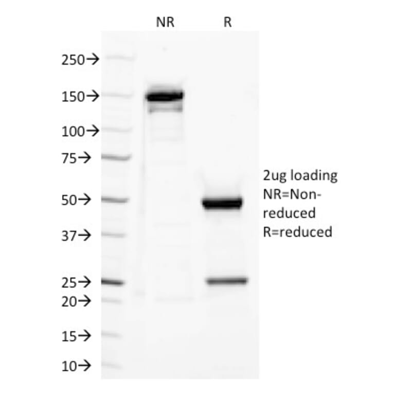 SDS-PAGE - Anti-TLR2 Antibody [TLR2/221] - BSA and Azide free (A253328) - Antibodies.com