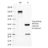 SDS-PAGE - Anti-TLR2 Antibody [TLR2/221] - BSA and Azide free (A253328) - Antibodies.com