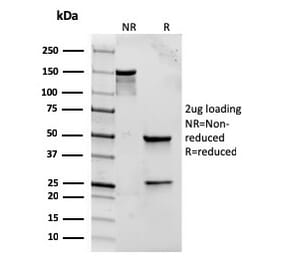 SDS-PAGE - Anti-TLR2 Antibody [rTLR2/221] - BSA and Azide free (A253329) - Antibodies.com
