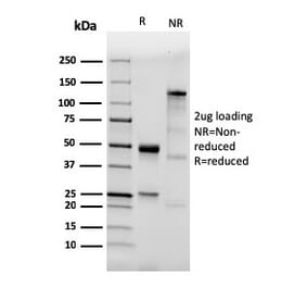 SDS-PAGE - Anti-TLR2 Antibody [TLR2/3894R] - BSA and Azide free (A253330) - Antibodies.com