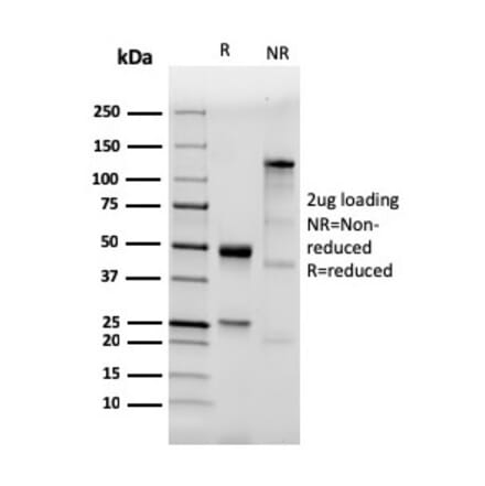 SDS-PAGE - Anti-TLR2 Antibody [TLR2/3894R] - BSA and Azide free (A253330) - Antibodies.com