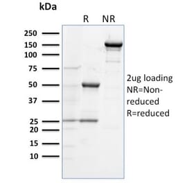 SDS-PAGE - Anti-TLR4 Antibody [TLR4/230] - BSA and Azide free (A253331) - Antibodies.com