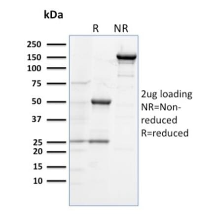 SDS-PAGE - Anti-TLR4 Antibody [TLR4/230] - BSA and Azide free (A253331) - Antibodies.com