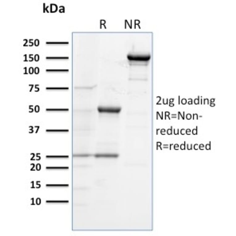 SDS-PAGE - Anti-TLR4 Antibody [TLR4/230] - BSA and Azide free (A253331) - Antibodies.com