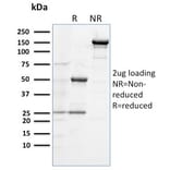 SDS-PAGE - Anti-TLR4 Antibody [TLR4/230] - BSA and Azide free (A253331) - Antibodies.com