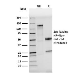 SDS-PAGE - Anti-TLR4 Antibody [TLR4/3895R] - BSA and Azide free (A253332) - Antibodies.com