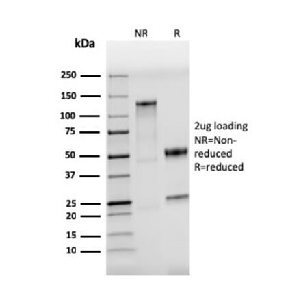 SDS-PAGE - Anti-TLR4 Antibody [TLR4/3895R] - BSA and Azide free (A253332) - Antibodies.com