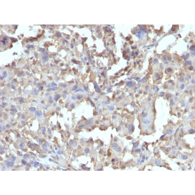 Immunohistochemistry - Anti-TNF alpha Antibody [TNF/1500R] - BSA and Azide free (A253335) - Antibodies.com