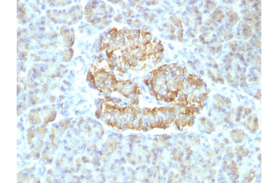 Immunohistochemistry - Anti-TNF alpha Antibody [TNF/1500R] - BSA and Azide free (A253336) - Antibodies.com