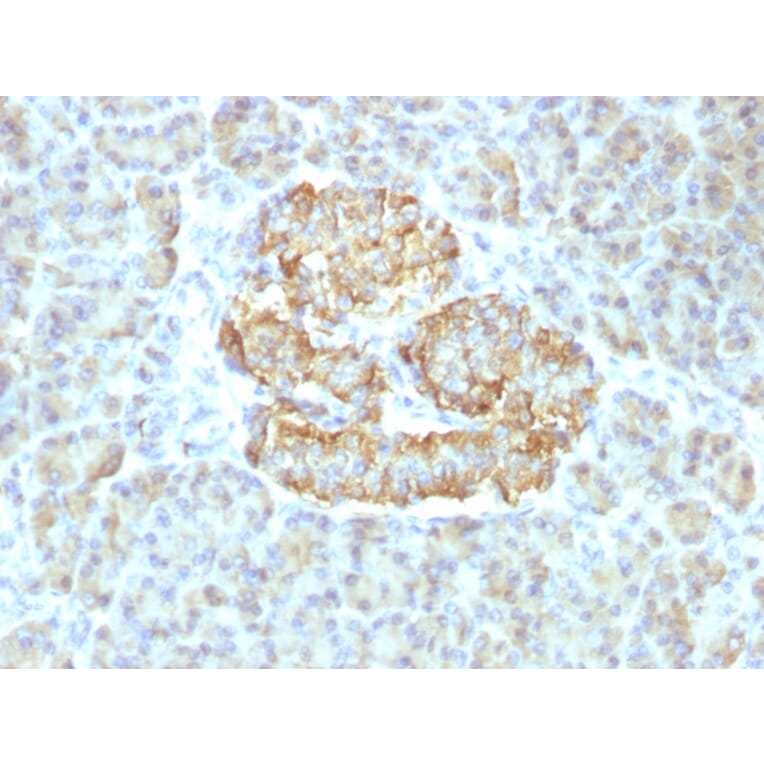 Immunohistochemistry - Anti-TNF alpha Antibody [TNF/1500R] - BSA and Azide free (A253336) - Antibodies.com