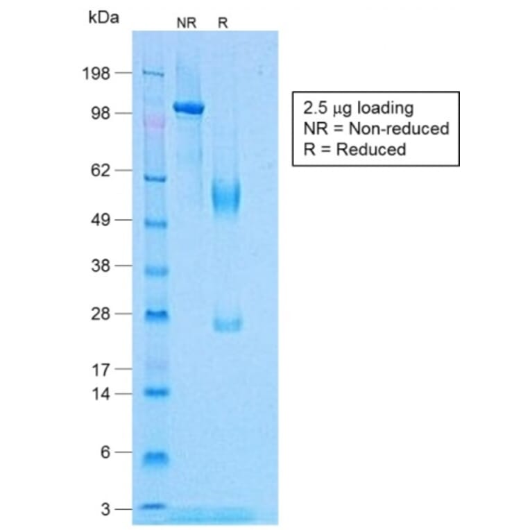 SDS-PAGE - Anti-TNF alpha Antibody [TNF/1500R] - BSA and Azide free (A253336) - Antibodies.com