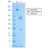 SDS-PAGE - Anti-TNF alpha Antibody [TNF/1500R] - BSA and Azide free (A253336) - Antibodies.com