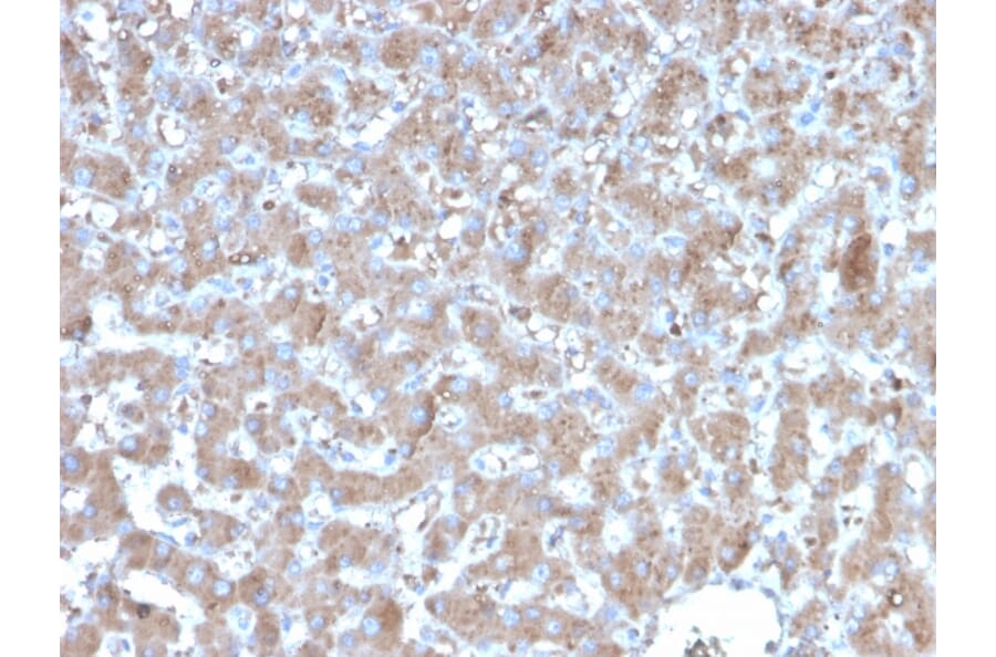 Immunohistochemistry - Anti-TNFAIP3 Antibody [TNFAIP3/2813] - BSA and Azide free (A253338) - Antibodies.com